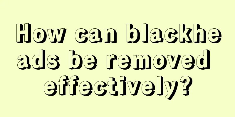 How can blackheads be removed effectively?