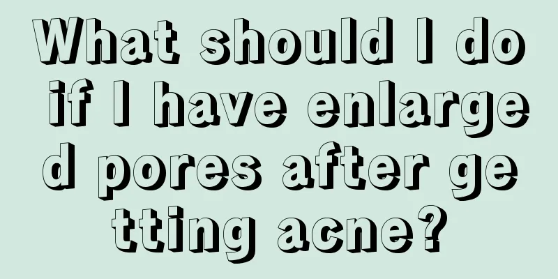 What should I do if I have enlarged pores after getting acne?