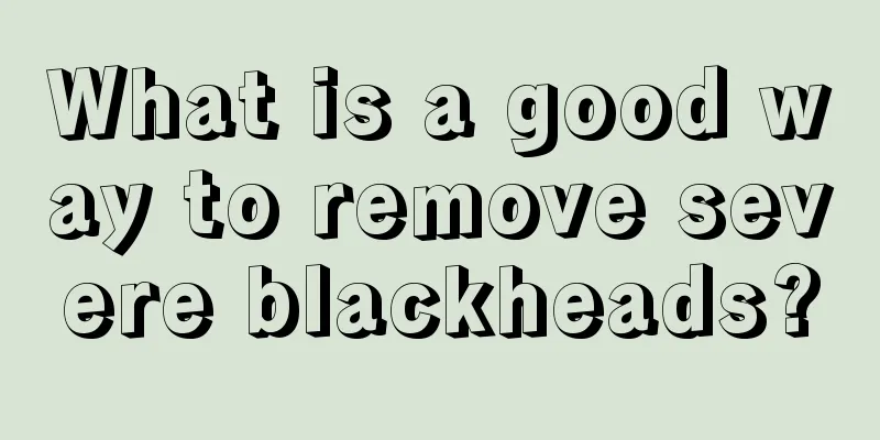 What is a good way to remove severe blackheads?