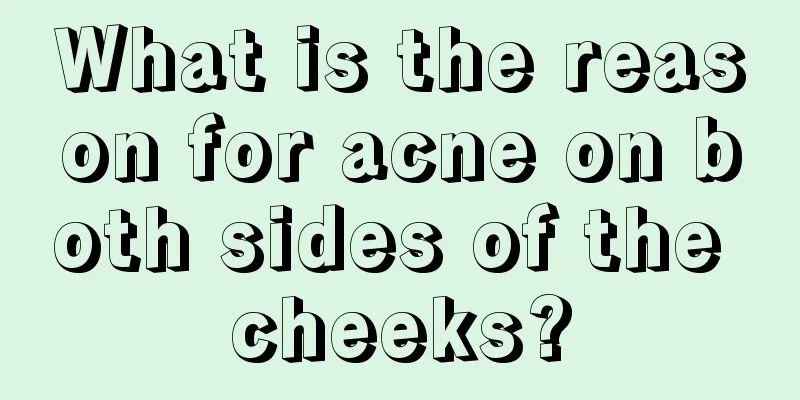 What is the reason for acne on both sides of the cheeks?