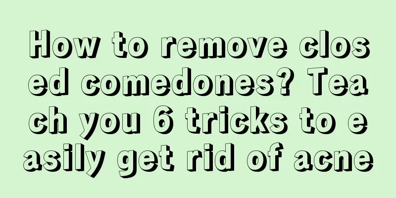 How to remove closed comedones? Teach you 6 tricks to easily get rid of acne