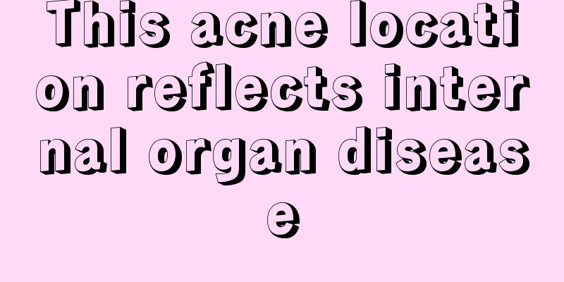 This acne location reflects internal organ disease