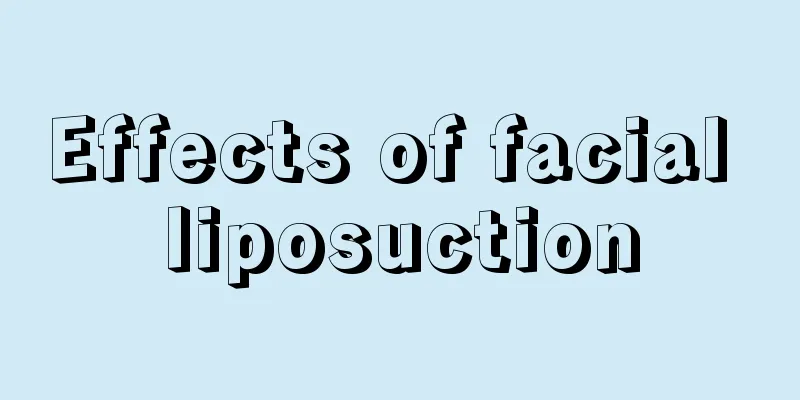 Effects of facial liposuction