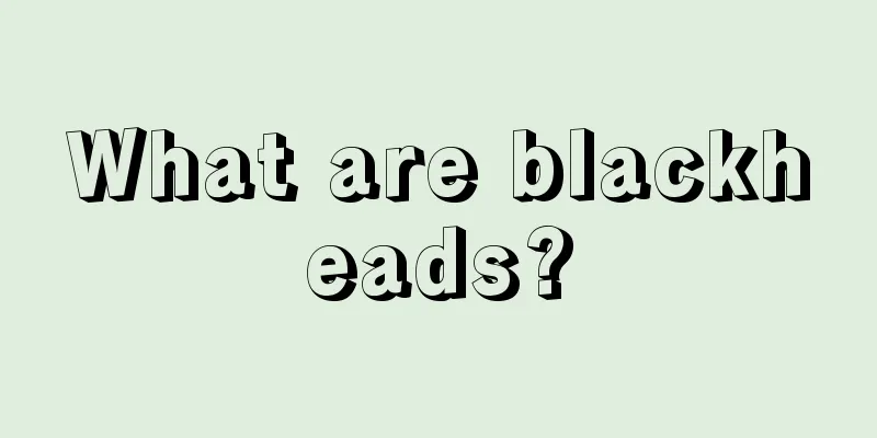 What are blackheads?