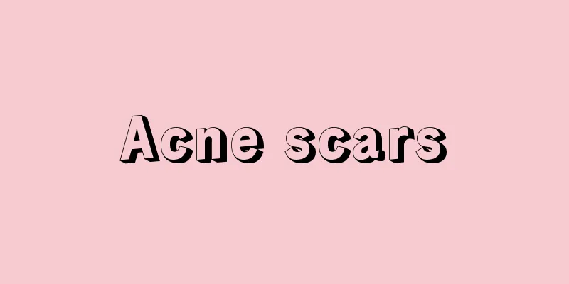 Acne scars