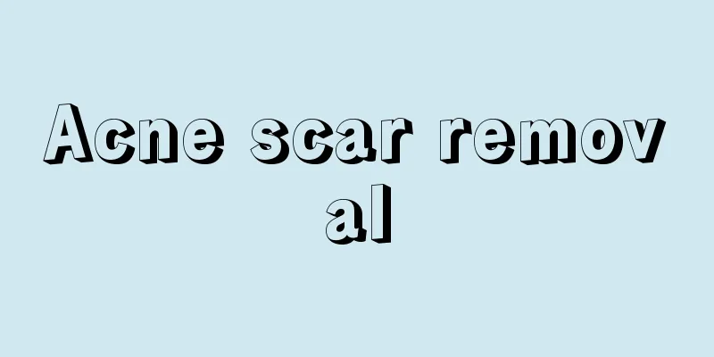 Acne scar removal