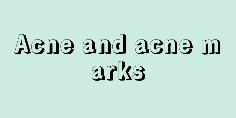 Acne and acne marks