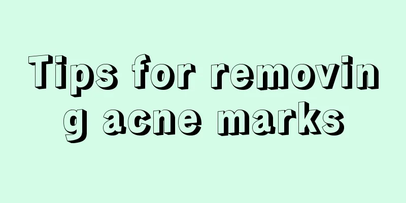 Tips for removing acne marks