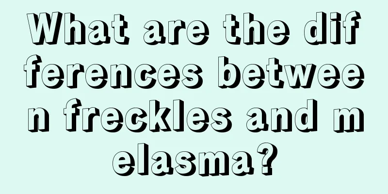 What are the differences between freckles and melasma?