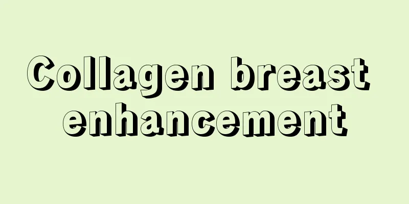 Collagen breast enhancement